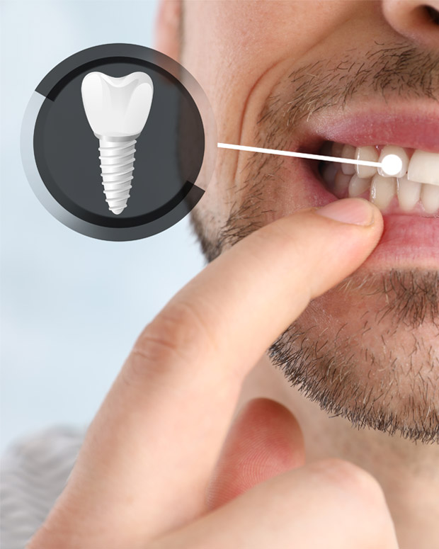 wcu dental implant Home