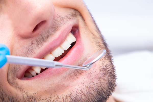 Dental Bridge Vs  Implants: Which Tooth Replacement Option Is Right For You?