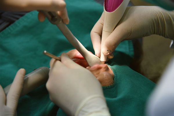 When Might Oral Surgery Be Needed?