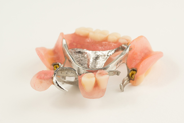 Options For Partial Dentures